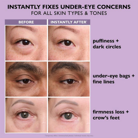 Instant FirmX Easy Wear Temporary Eye Tightener